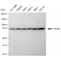KD-Validated VPS35 Rabbit mAb (20 μl)