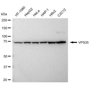 KD-Validated VPS35 Rabbit mAb (20 μl)