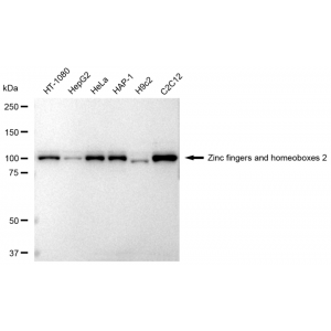 KD-Validated ZHX2 Rabbit mAb (20 μl)