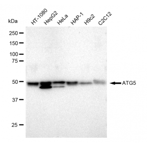 KD-Validated ATG5 Rabbit mAb (20 μl)