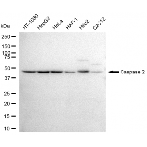 KD-Validated CASP2 Rabbit mAb (20 μl)