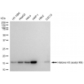 KD-Validated Histone H3 (acetyl K9) Rabbit mAb (20 μl)