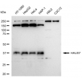KD-Validated HAUS7 Rabbit mAb (20 μl)