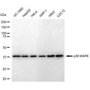 KD-Validated p38 MAPK Rabbit mAb (20 μl)