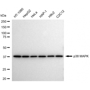 KD-Validated p38 MAPK Rabbit mAb (20 μl)