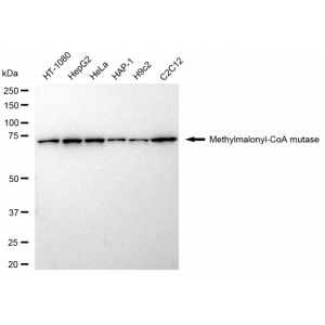 KD-Validated MMUT Rabbit mAb (20 μl)