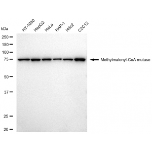 KD-Validated MMUT Rabbit mAb (20 μl)