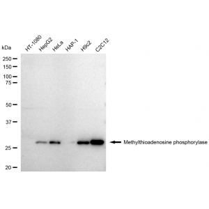 KD-Validated MTAP Rabbit mAb (20 μl)