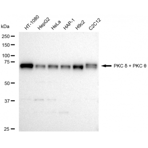 KD-Validated PRKCD Rabbit mAb (20 μl)