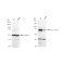 KD-Validated PRKCD Rabbit mAb (20 μl)
