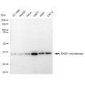 KD-Validated RAD51 Rabbit mAb (20 μl)