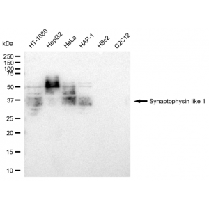 KD-Validated SYPL1 Rabbit mAb (20 μl)