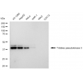 KD-Validated TRIB3 Rabbit mAb (20 μl)