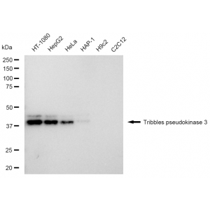 KD-Validated TRIB3 Rabbit mAb (20 μl)