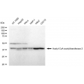 KD-Validated ACAT2 Rabbit mAb (20 μl)