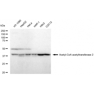 KD-Validated ACAT2 Rabbit mAb (20 μl)