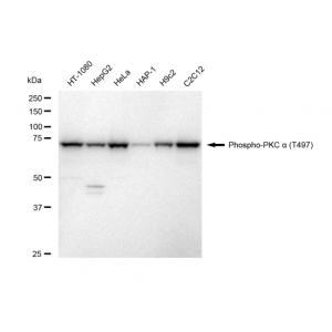 KD-Validated Phospho-PKCA (T497) Rabbit mAb (20 μl)