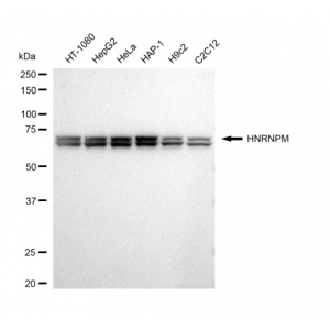 KD-Validated HNRNPM Rabbit mAb (20 μl)