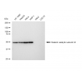 KD-Validated KATNA1 Rabbit mAb (20 μl)