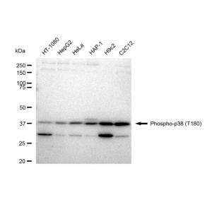 KD-Validated Phospho-p38 (T180) Rabbit mAb (20 μl)