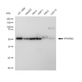 KD-Validated PFKFB3 Rabbit mAb (20 μl)