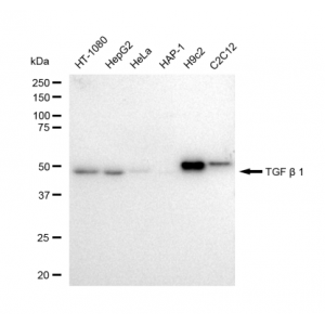 KD-Validated TGFB1 Rabbit mAb (20 μl)