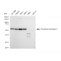 KD-Validated TXNRD2 Rabbit mAb (20 μl)
