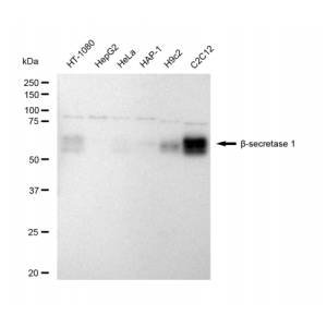 KD-Validated BACE1 Rabbit mAb (20 μl)