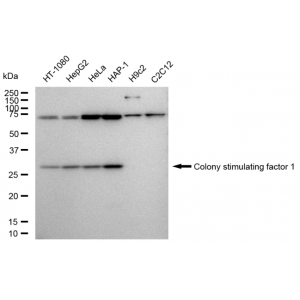 KD-Validated CSF1 Rabbit mAb (20 μl)
