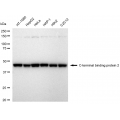 KD-Validated CTBP2 Rabbit mAb (20 μl)