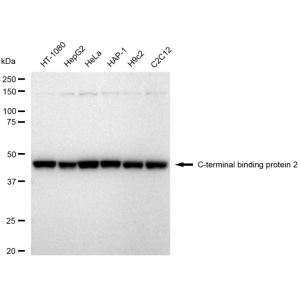 KD-Validated CTBP2 Rabbit mAb (20 μl)