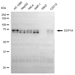 KD-Validated DCP1A Rabbit mAb (20 μl)