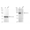 KD-Validated DCP1A Rabbit mAb (20 μl)
