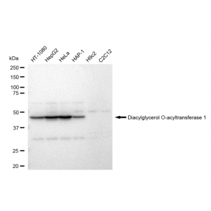 KD-Validated DGAT1 Rabbit mAb (20 μl)
