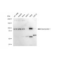 KD-Validated DSC1 Rabbit mAb (20 μl)