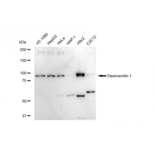 KD-Validated DSC1 Rabbit mAb (20 μl)