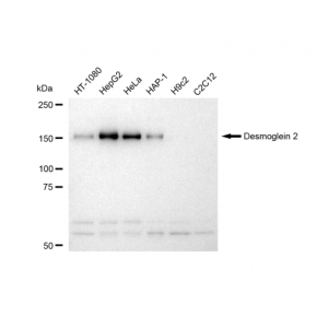 KD-Validated DSG2 Rabbit mAb (20 μl)