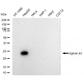 KD-Validated Ephrin A1 Rabbit mAb (20 μl)