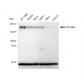 KD-Validated EIF2AK4 Rabbit mAb (20 μl)