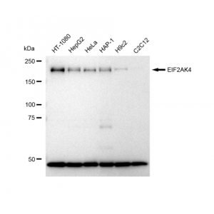 KD-Validated EIF2AK4 Rabbit mAb (20 μl)