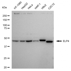 KD-Validated ELP4 Rabbit mAb (20 μl)