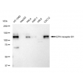 KD-Validated EPHB1 Rabbit mAb (20 μl)