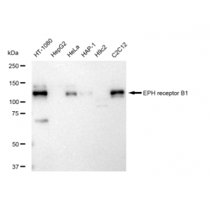 KD-Validated EPHB1 Rabbit mAb (20 μl)
