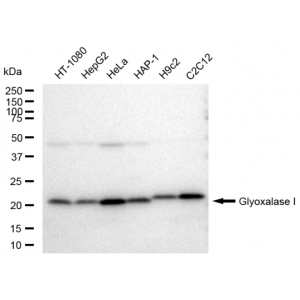 KD-Validated GLO1 Rabbit mAb (20 μl)