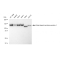 KD-Validated GOLIM4 Rabbit mAb (20 μl)