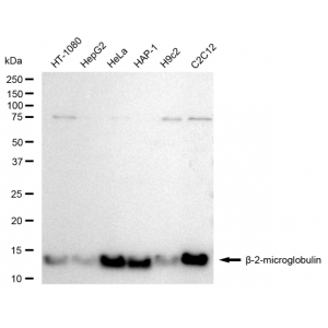 KD-Validated B2M Rabbit mAb (20 μl)