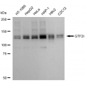 KD-Validated GTF2I Rabbit mAb (20 μl)