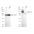 KD-Validated GTF2I Rabbit mAb (20 μl)