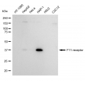 KD-Validated F11R Rabbit mAb (20 μl)
