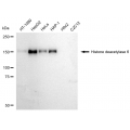 KD-Validated HDAC6 Rabbit mAb (20 μl)